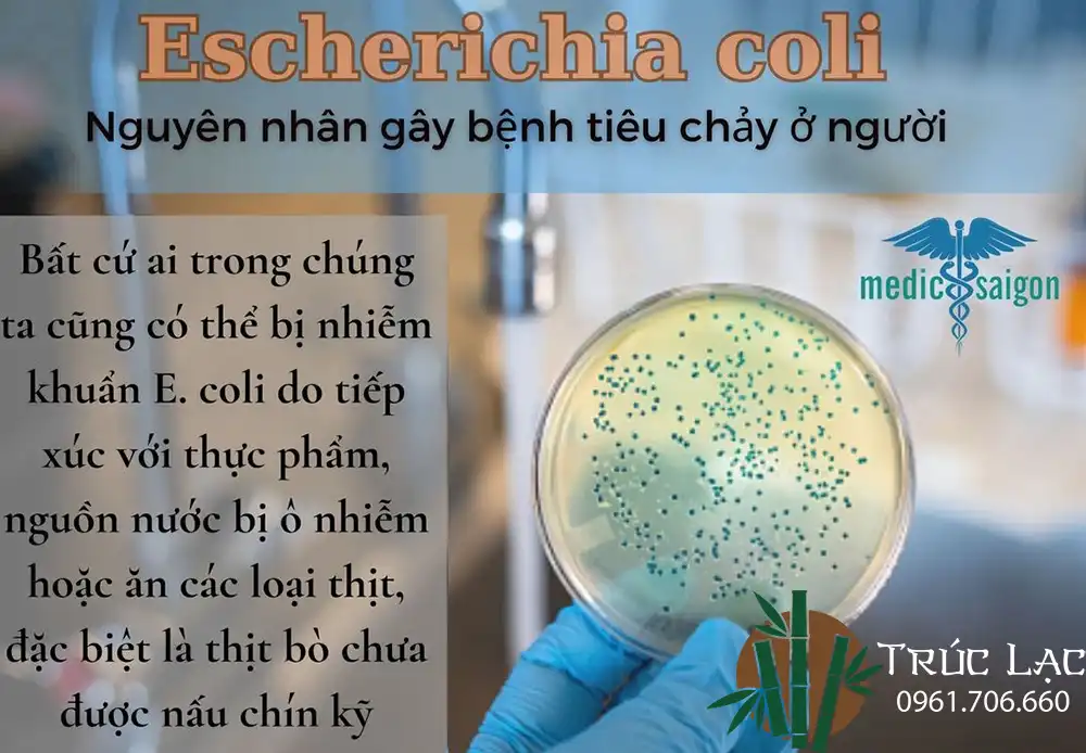 Vi khuẩn E. coli gây bệnh tiêu chảy